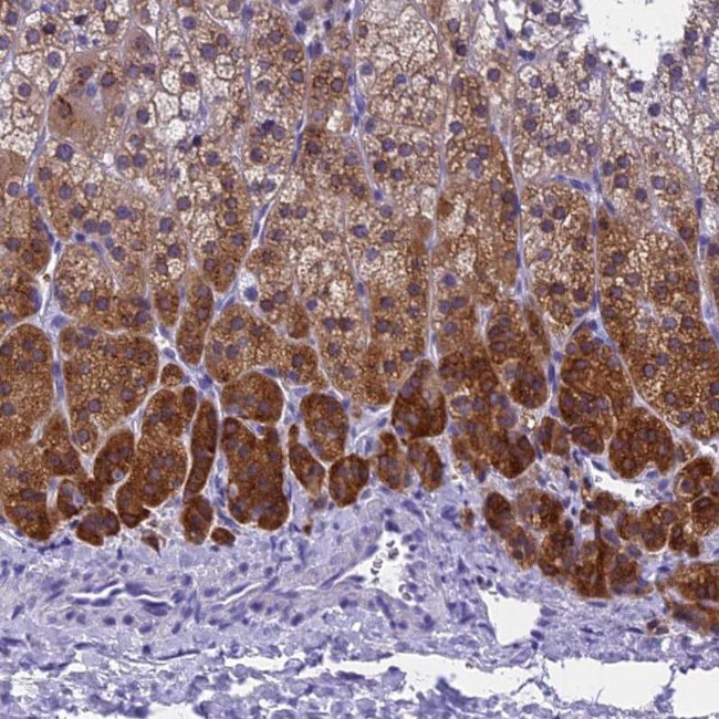 KCTD14 Antibody in Immunohistochemistry (IHC)