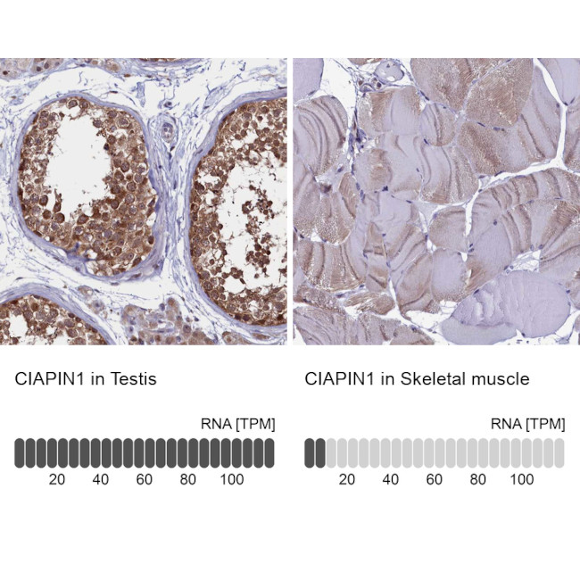 CIAPIN1 Antibody in Immunohistochemistry (IHC)