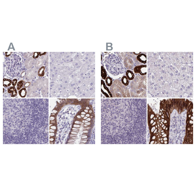 HSD11B2 Antibody in Immunohistochemistry (IHC)