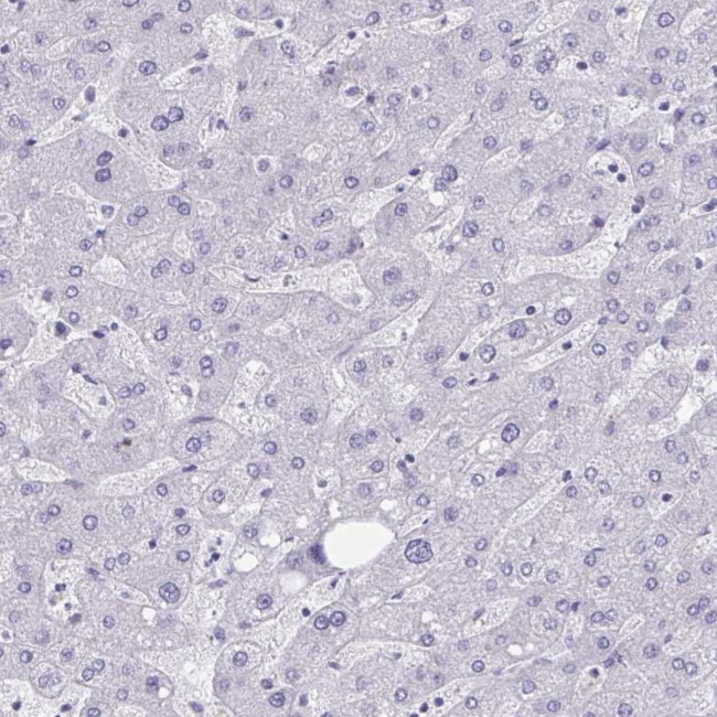 HSD11B2 Antibody in Immunohistochemistry (IHC)