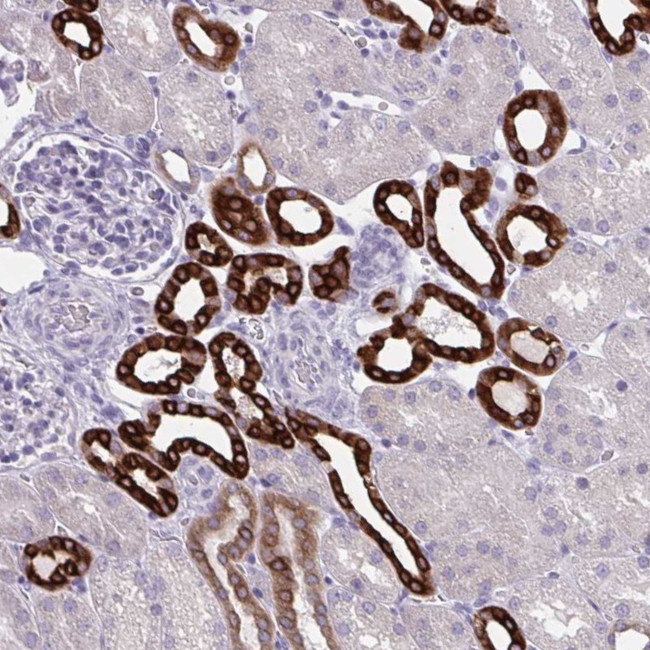 HSD11B2 Antibody in Immunohistochemistry (IHC)