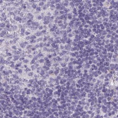 HSD11B2 Antibody in Immunohistochemistry (IHC)