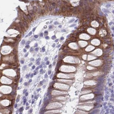 HSD11B2 Antibody in Immunohistochemistry (IHC)