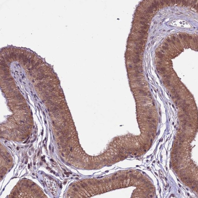 SPRED1 Antibody in Immunohistochemistry (IHC)