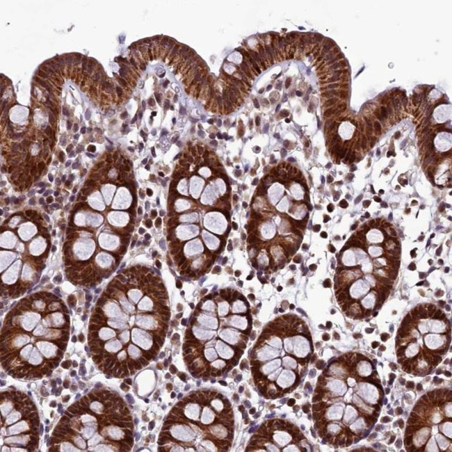 RPUSD2 Antibody in Immunohistochemistry (IHC)