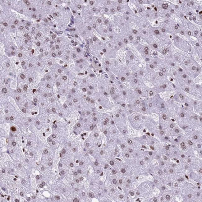 Histone H4 Antibody in Immunohistochemistry (IHC)