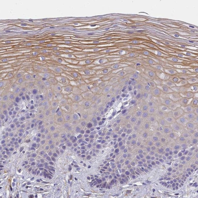 MVB12A Antibody in Immunohistochemistry (IHC)