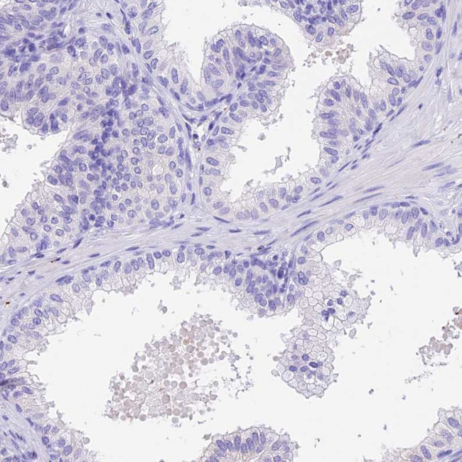 PSG11 Antibody in Immunohistochemistry (IHC)