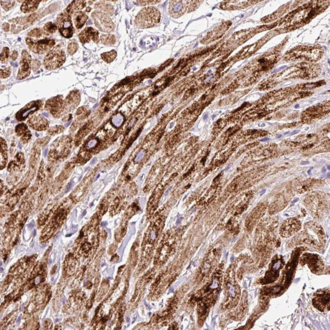 PAM Antibody in Immunohistochemistry (IHC)