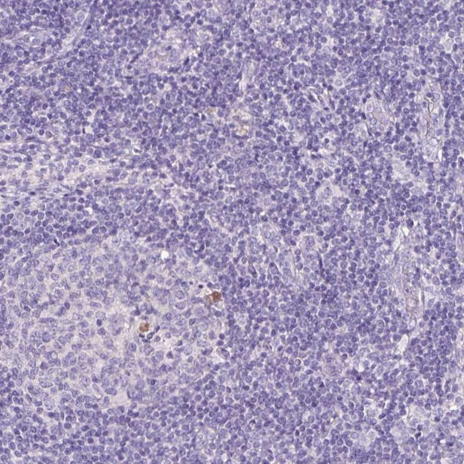 PAM Antibody in Immunohistochemistry (IHC)