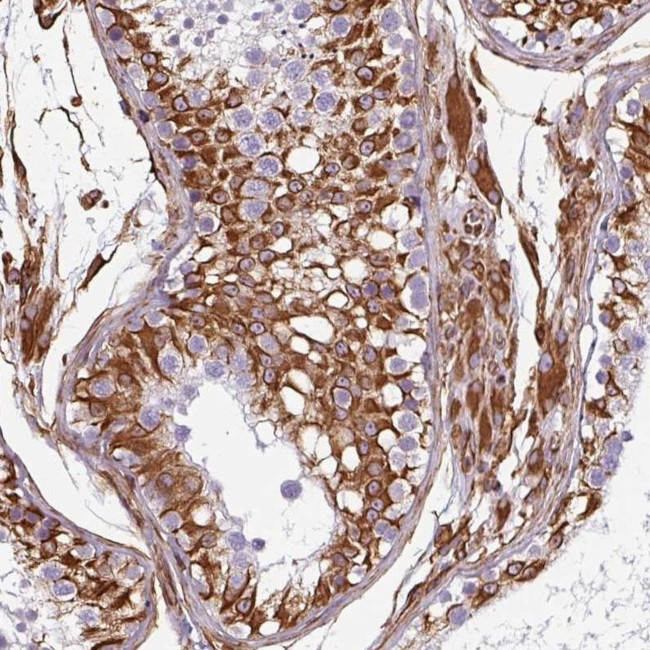 PPFIA1 Antibody in Immunohistochemistry (IHC)