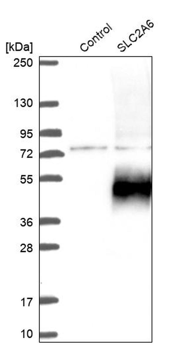 SLC2A6 Antibody in Western Blot (WB)