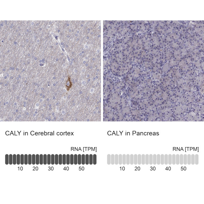 CALY Antibody in Immunohistochemistry (IHC)