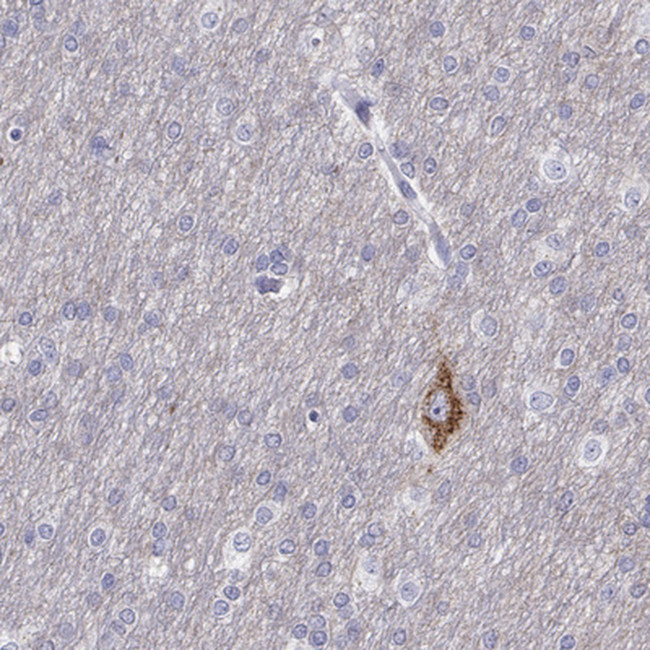 CALY Antibody in Immunohistochemistry (IHC)