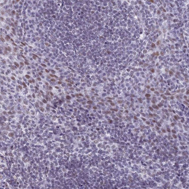 ASH2L Antibody in Immunohistochemistry (IHC)