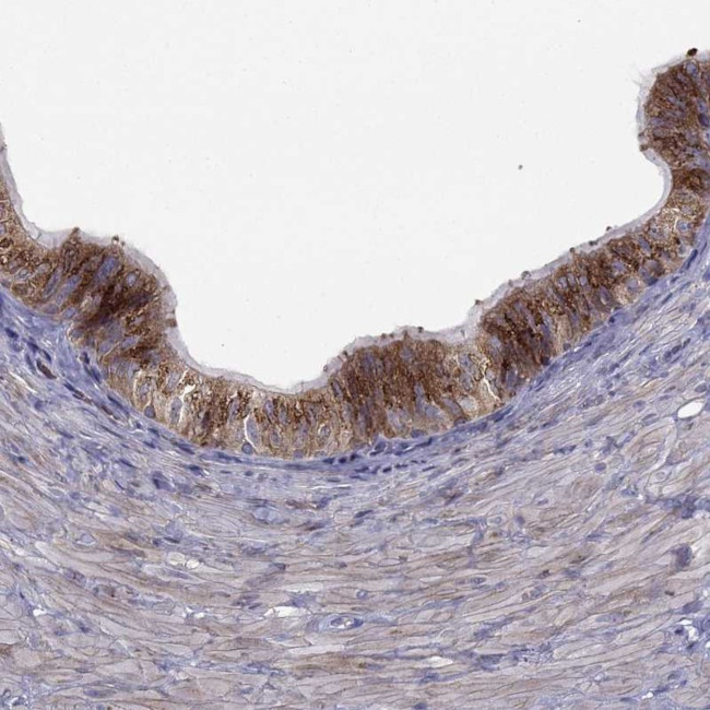 B4GALT7 Antibody in Immunohistochemistry (IHC)