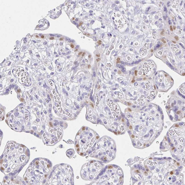 VGLL1 Antibody in Immunohistochemistry (IHC)