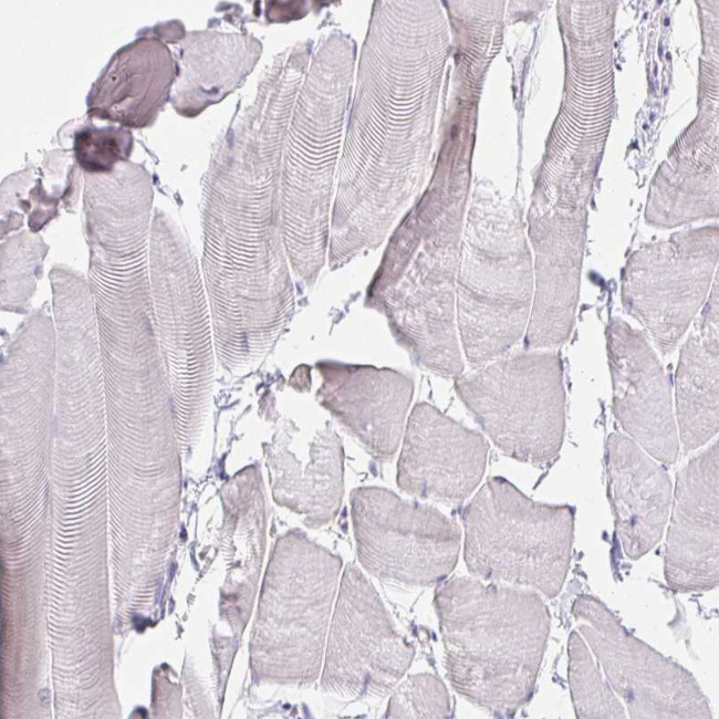 VGLL1 Antibody in Immunohistochemistry (IHC)