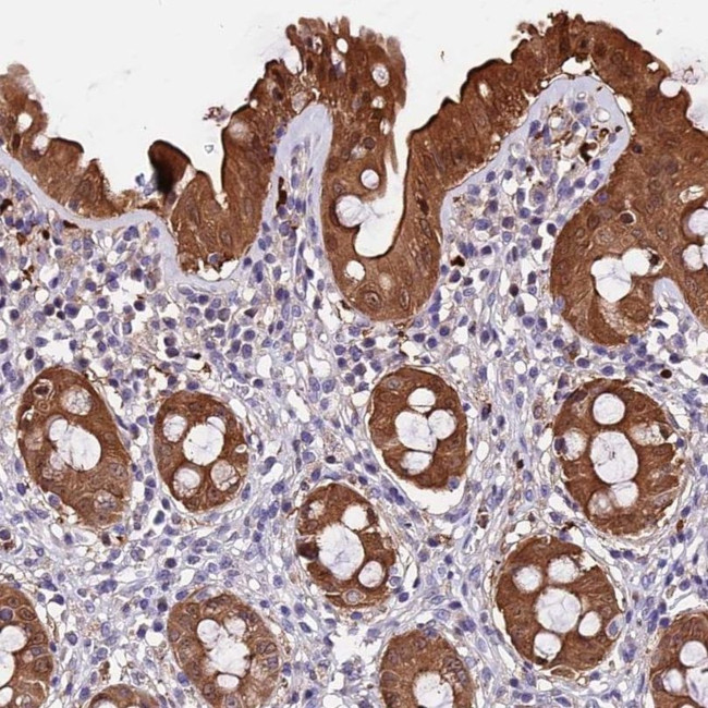 C21orf7 Antibody in Immunohistochemistry (IHC)