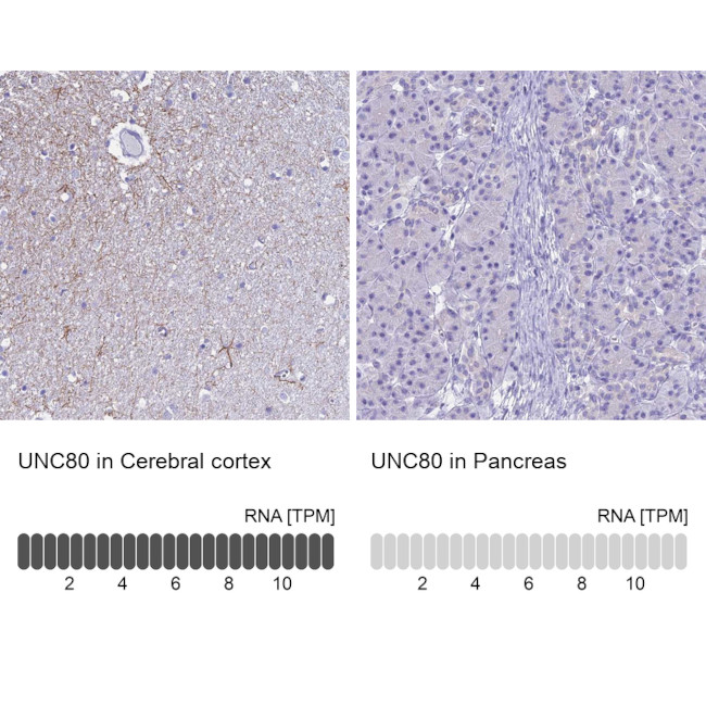 UNC80 Antibody in Immunohistochemistry (IHC)