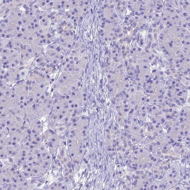 UNC80 Antibody in Immunohistochemistry (IHC)