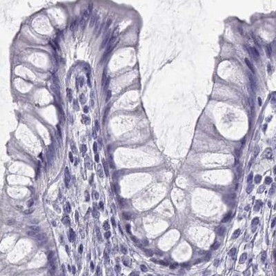 SEMG1 Antibody in Immunohistochemistry (IHC)