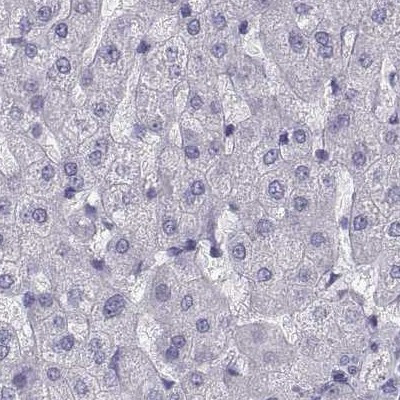 SEMG1 Antibody in Immunohistochemistry (IHC)