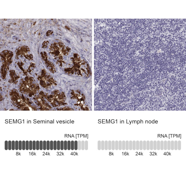 SEMG1 Antibody