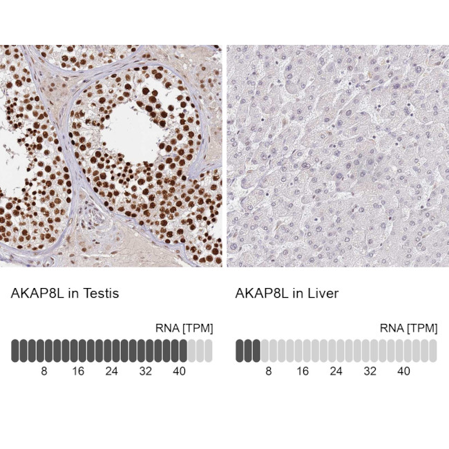 AKAP8L Antibody in Immunohistochemistry (IHC)
