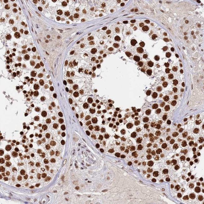 AKAP8L Antibody in Immunohistochemistry (IHC)