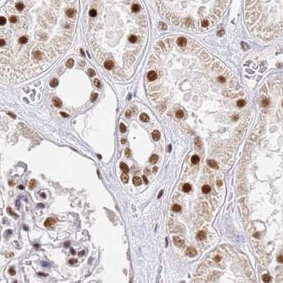 AKAP8L Antibody in Immunohistochemistry (IHC)