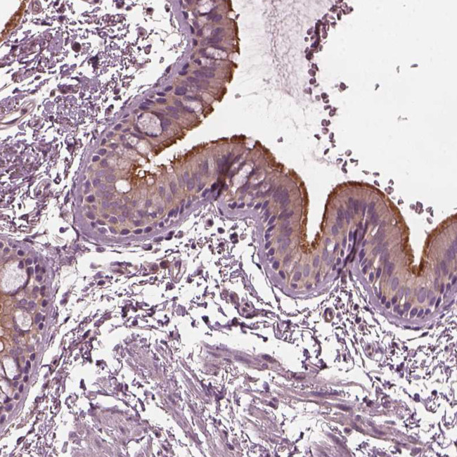 CCDC114 Antibody in Immunohistochemistry (IHC)