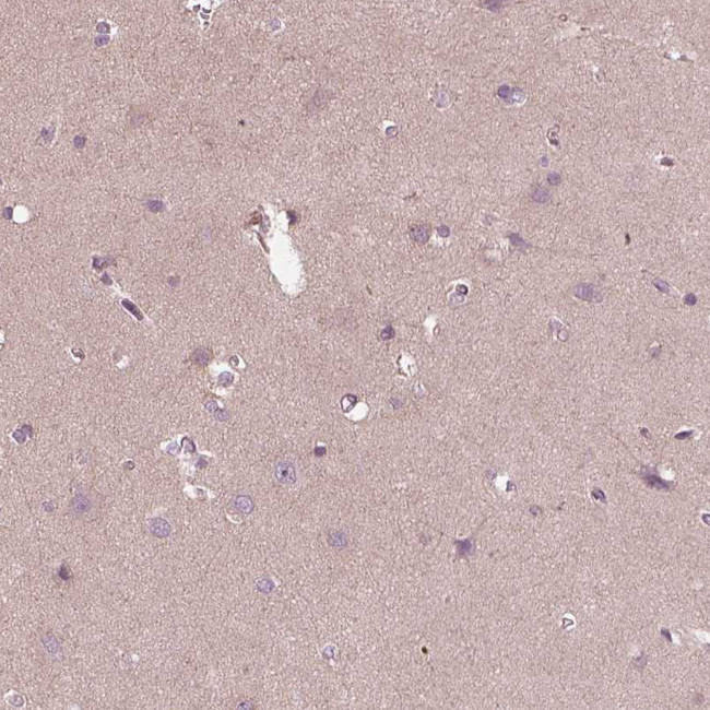 CCDC114 Antibody in Immunohistochemistry (IHC)