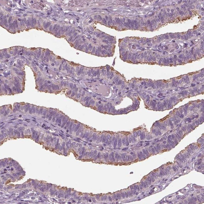 CCDC114 Antibody in Immunohistochemistry (IHC)