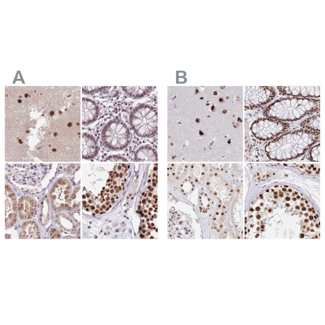 AKAP8L Antibody in Immunohistochemistry (IHC)