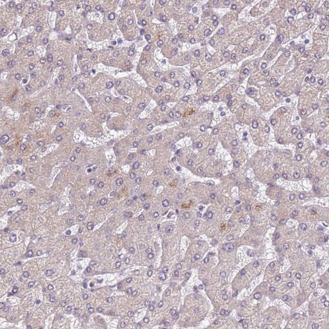 AKAP8L Antibody in Immunohistochemistry (IHC)