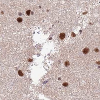 AKAP8L Antibody in Immunohistochemistry (IHC)