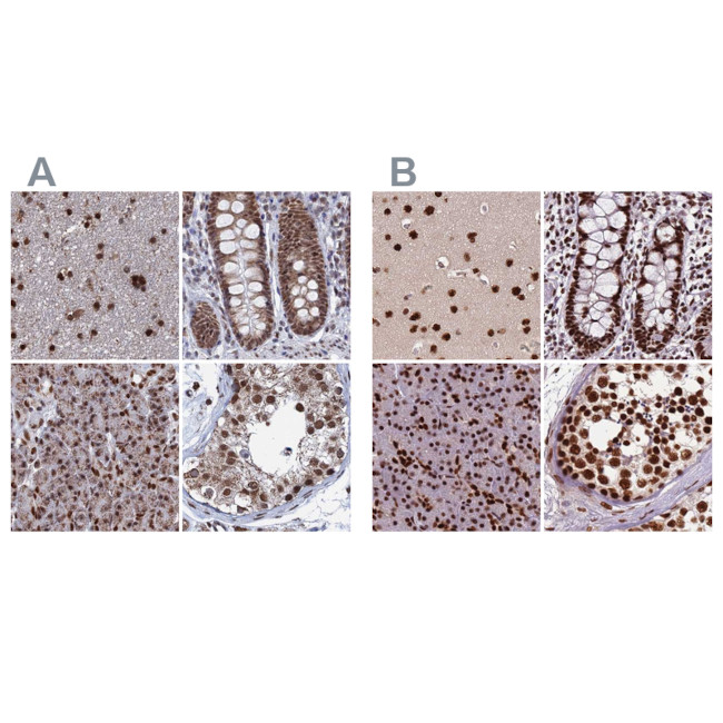 HDGFRP2 Antibody in Immunohistochemistry (IHC)