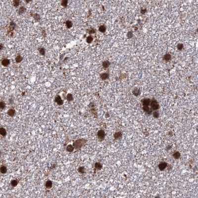 HDGFRP2 Antibody in Immunohistochemistry (IHC)