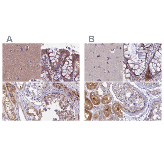 DUS2L Antibody in Immunohistochemistry (IHC)