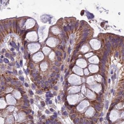 DUS2L Antibody in Immunohistochemistry (IHC)