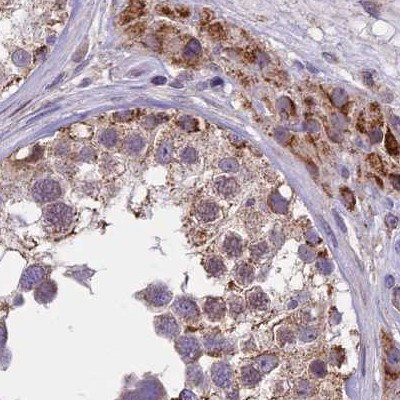 DUS2L Antibody in Immunohistochemistry (IHC)