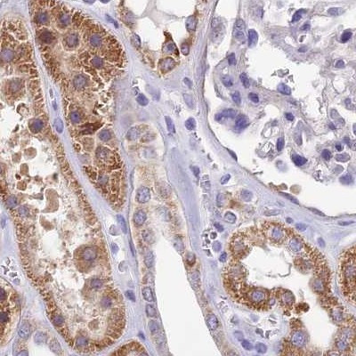 DUS2L Antibody in Immunohistochemistry (IHC)