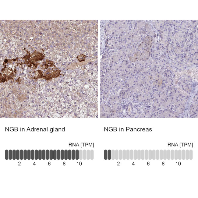 NGB Antibody in Immunohistochemistry (IHC)