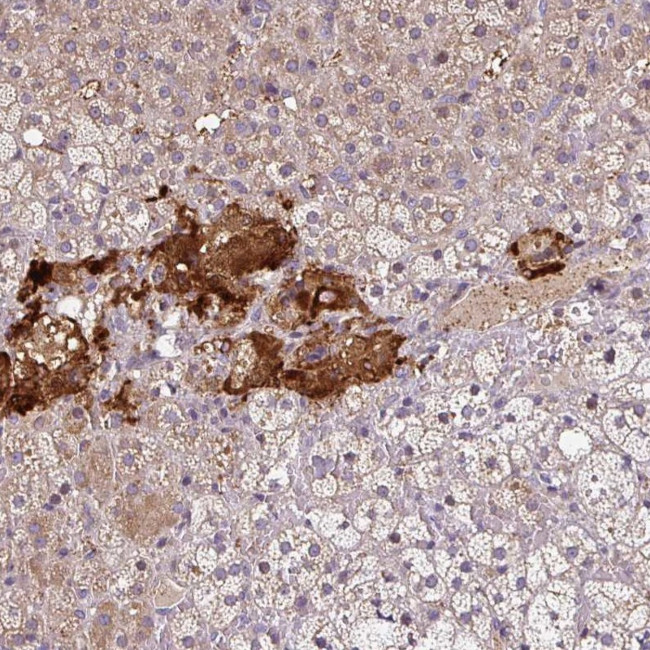 NGB Antibody in Immunohistochemistry (IHC)