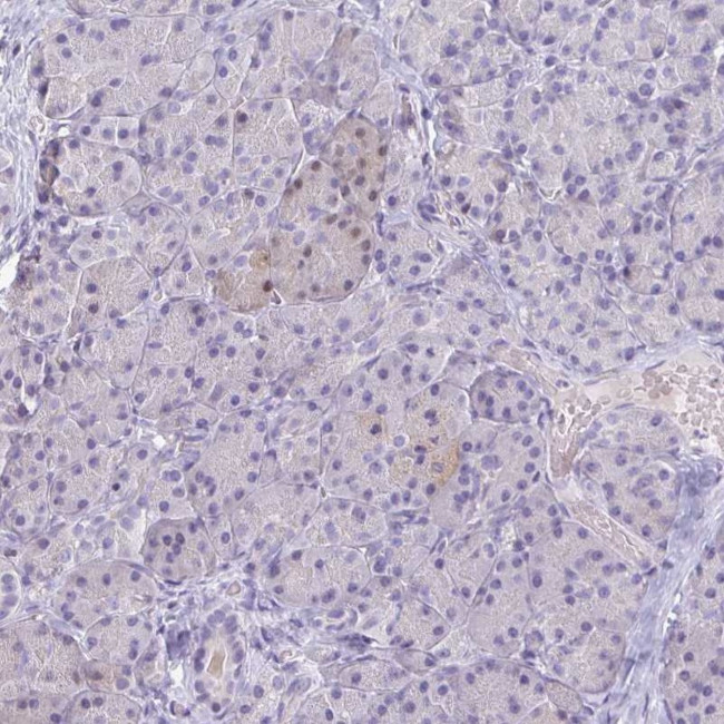 NGB Antibody in Immunohistochemistry (IHC)