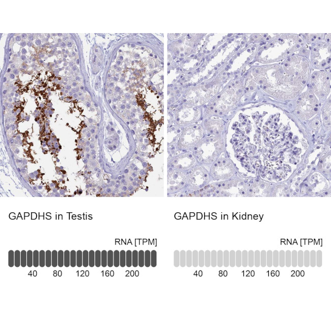 GAPDHS Antibody in Immunohistochemistry (IHC)