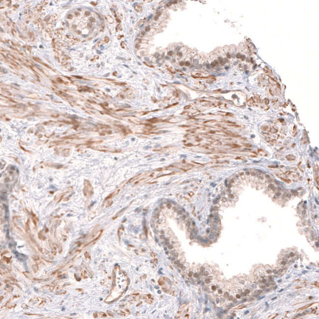 SMC6 Antibody in Immunohistochemistry (IHC)