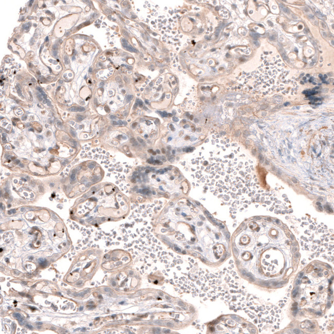 SMC6 Antibody in Immunohistochemistry (IHC)