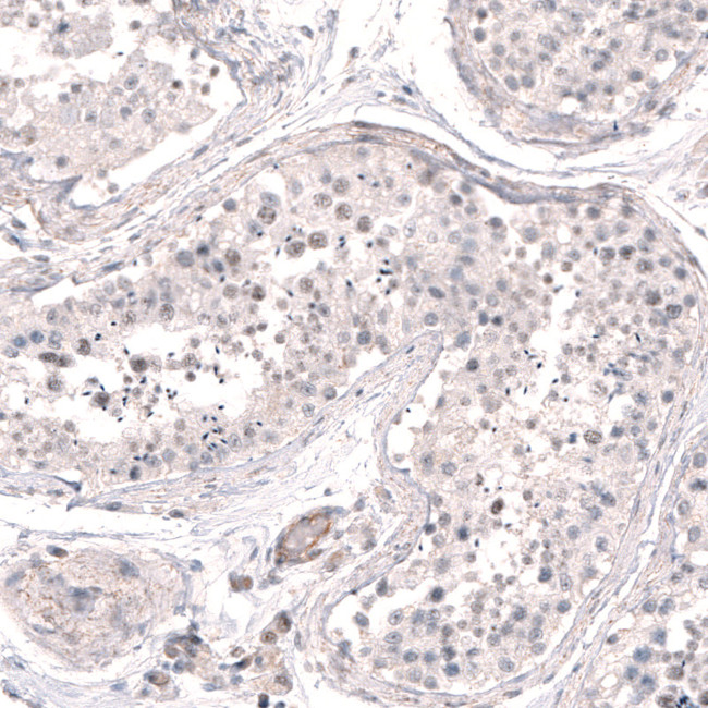 SMC6 Antibody in Immunohistochemistry (IHC)